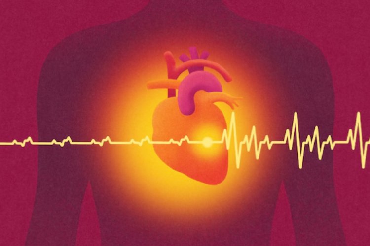 Intermittent fasting increases the risk of heart disease death.